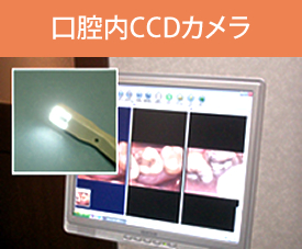 口腔内CCDカメラ